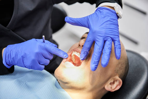 Best Dental Abscess Treatment in Ridge Manor, FL