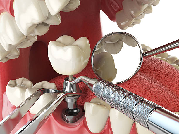 Best Urgent Dental Care for Toothaches in Ridge Manor, FL