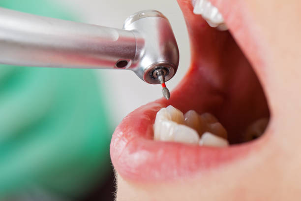 Best Emergency Denture Repair in Ridge Manor, FL